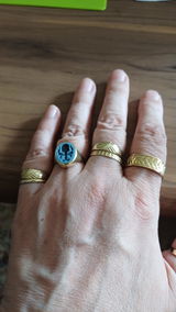 Anonym review photo