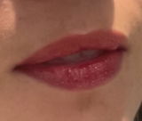 Anonyme review photo