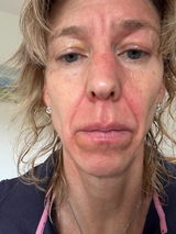 Anonymous review photo