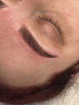 Anonymous review photo