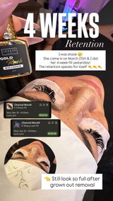 LoraLynn review photo