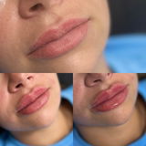 Cassidy review photo