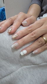 Anonymous review photo