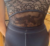 Anonymous review photo