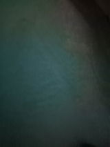 Anonyme review photo