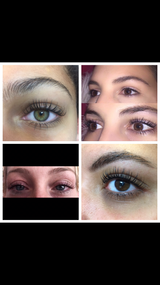 Anonyme review photo