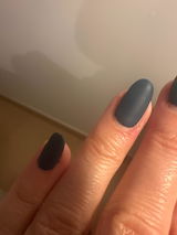 Anonyme review photo