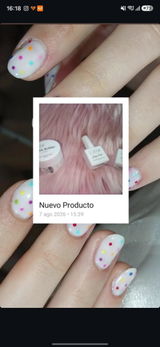 Anonyme review photo