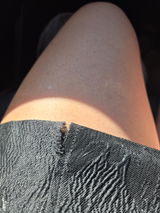Anonymous review photo