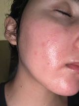 Rosa review photo