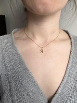 Anonymous review photo