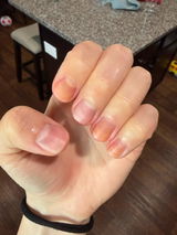Anonymous review photo