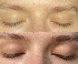 Anonīms review photo