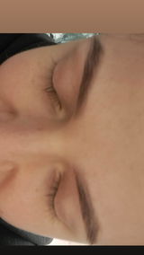 Anonīms review photo