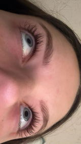 Anonīms review photo
