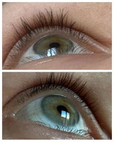 Anonīms review photo