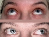 Anonīms review photo