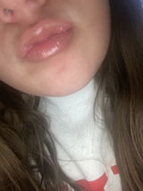 Anonymous review photo