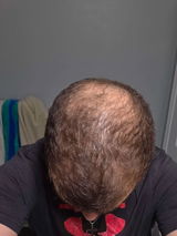 Marcelo Tapia review photo