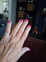 Anonymous review photo