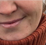 Anonymní review photo