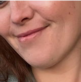 Anonymní review photo