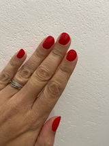 Anonyme review photo