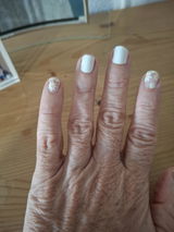 Anonyme review photo