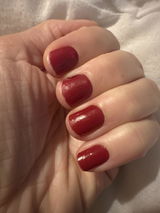Anonyme review photo