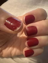 Anonyme review photo