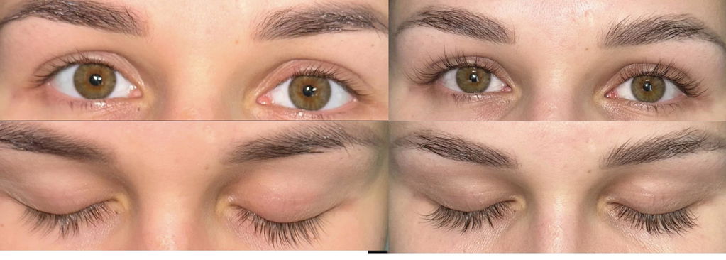 Natural Eyelash Serum 3ml
