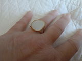 Anonyme review photo