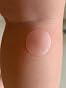 SUPERBAND Bug Bite Relief