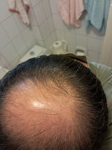 Mahmut Bora Erzen review photo