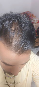 Rk review photo