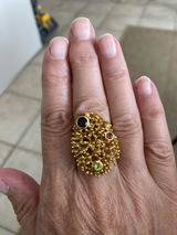 Anonyme review photo
