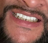Nitin review photo