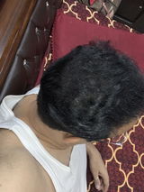 Biren review photo