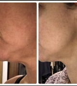 Millie review photo