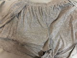 匿名 review photo