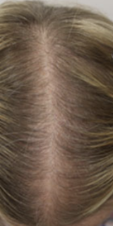 MANE Roots - All Natural Hair and Scalp Treatment Oil (60ml)
