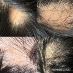 Review picture