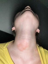 Agne review photo