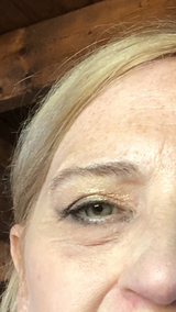Anonyme review photo