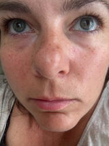 Anonyme review photo