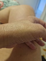 Anapgmbelem review photo