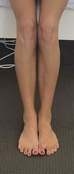 Review picture
