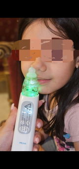 Remie review photo