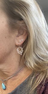 Allie review photo