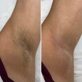 EricksonLaurie review photo